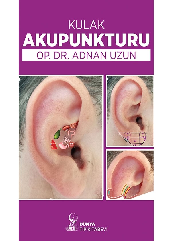 Kulak Akupunkturu